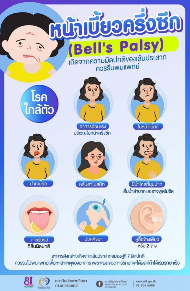 ประชาสัมพันธ์ หน้าเบี้ยวครึ่งซีก (Bells Palsy )